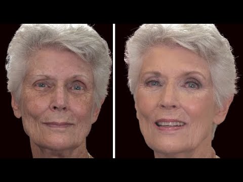 Mature makeup for hyperpigmentation