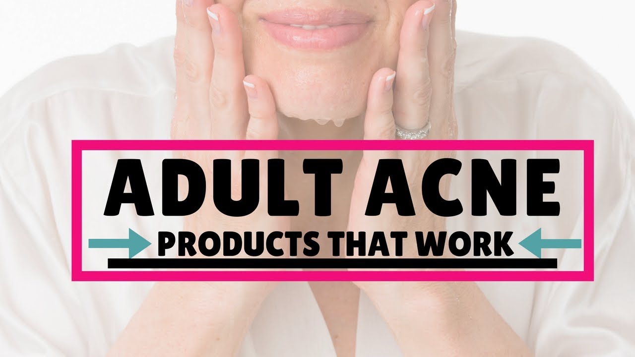 Treating adult acne on mature skin without over-drying