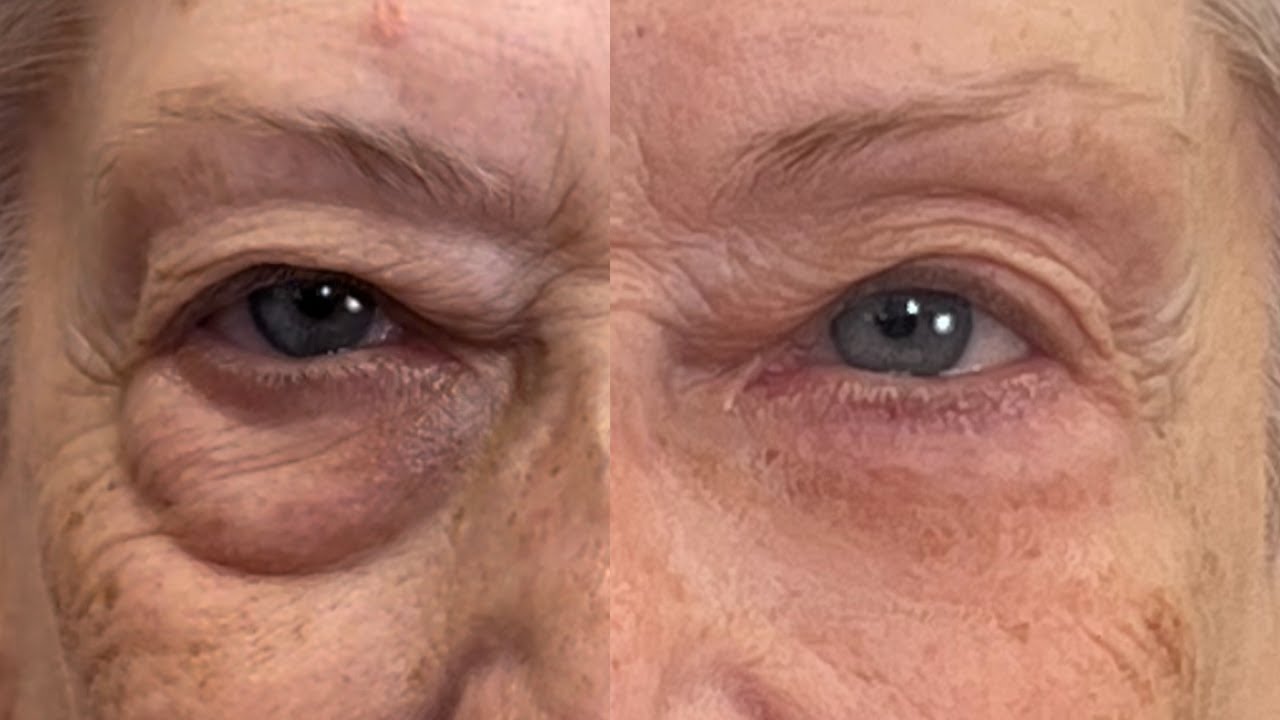 Instantly Banish Eye Bags: A Viral Product Test & Makeup Magic