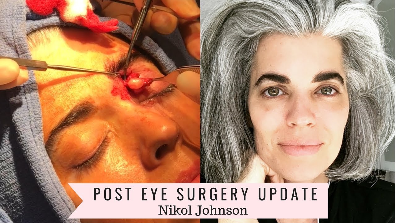Nikol Johnson shares an honest plastic surgery recovery update